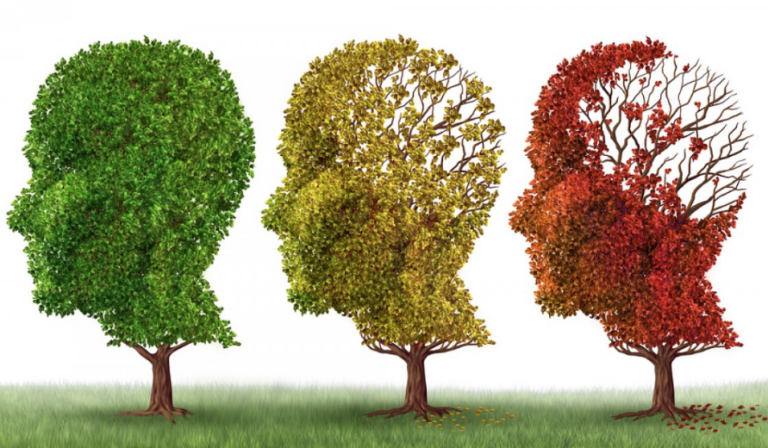 ¿Qué es el Alzheimer? Como y donde conseguir la mejor información sobre esta enfermedad