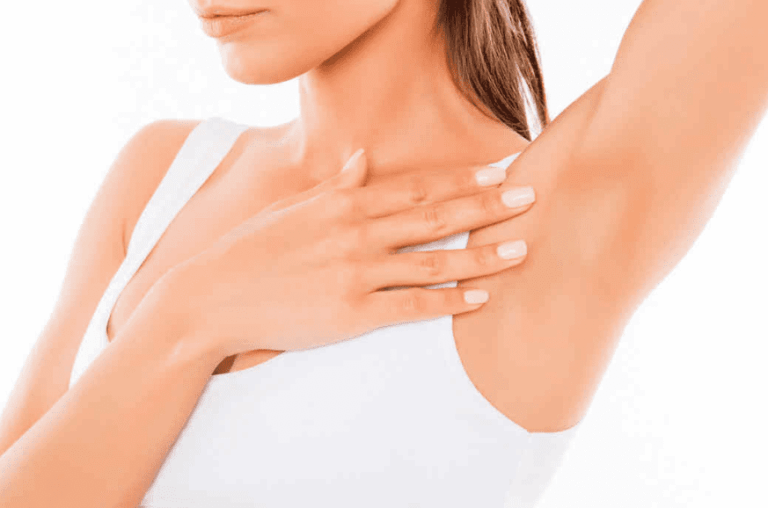 ¿Nódulos en las axilas? Podría tratarse de Hidrosadenitis Supurativa