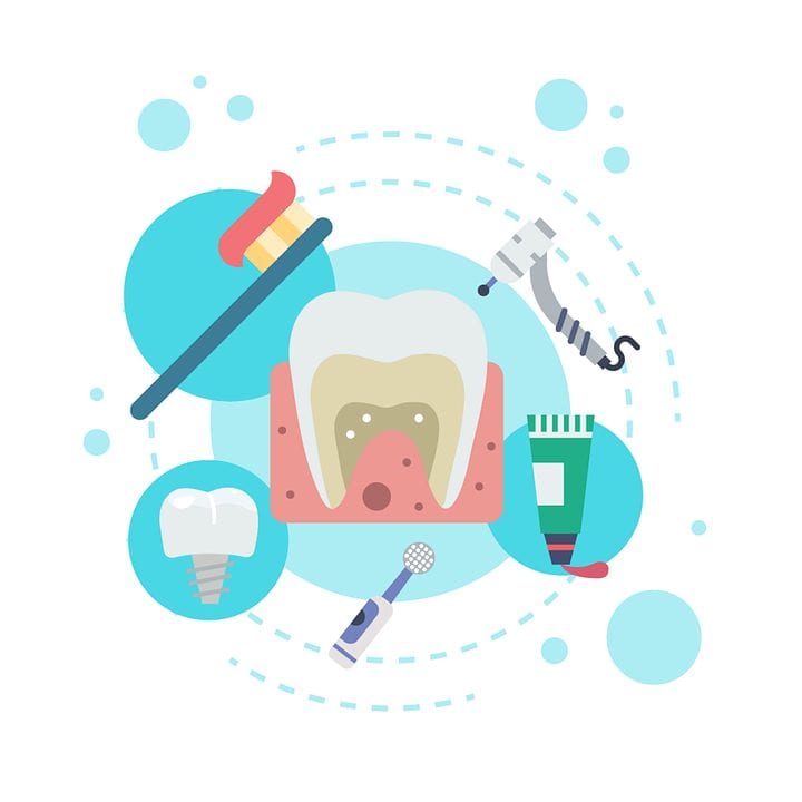 ¿Qué ventajas tiene un blanqueamiento dental profesional?