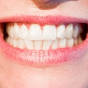 Ayudas para gozar de una buena salud bucal
