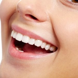 Funda dental: Qué es y para qué sirve