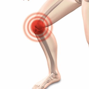 Formas de prevenir la artrosis