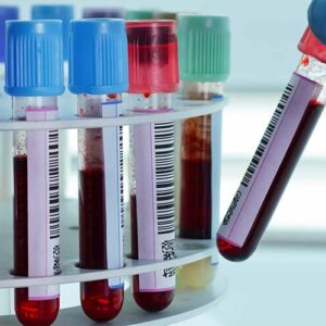 Siete tipos de cáncer podrán ser detectados con un "nuevo y sencillo" análisis de sangre desarrollado en EEUU