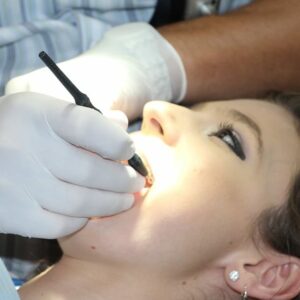 Consejos de belleza para afrontar el invierno: endodoncia y arañas vasculares