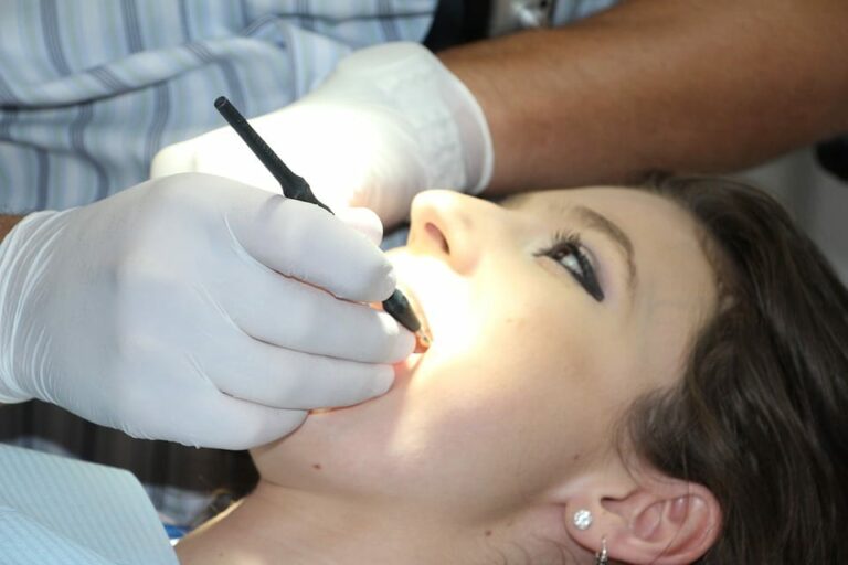 Consejos de belleza para afrontar el invierno: endodoncia y arañas vasculares