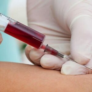 Se organiza la extracción de plasma hiperinmune de pacientes curados del coronavirus