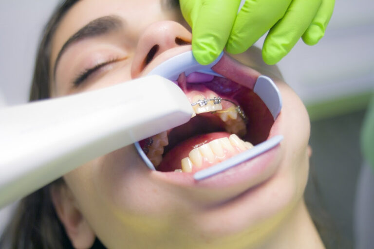 Las ortodoncias y otros cuidados dentales en época de coronavirus