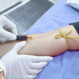 ¿Para qué sirve el test de ADN fetal en sangre materna?