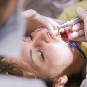 Las mejores soluciones con implantes dentales