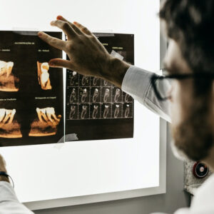 ¿Implantes dentales o dentadura postiza?