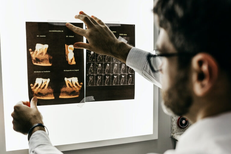 ¿Implantes dentales o dentadura postiza?