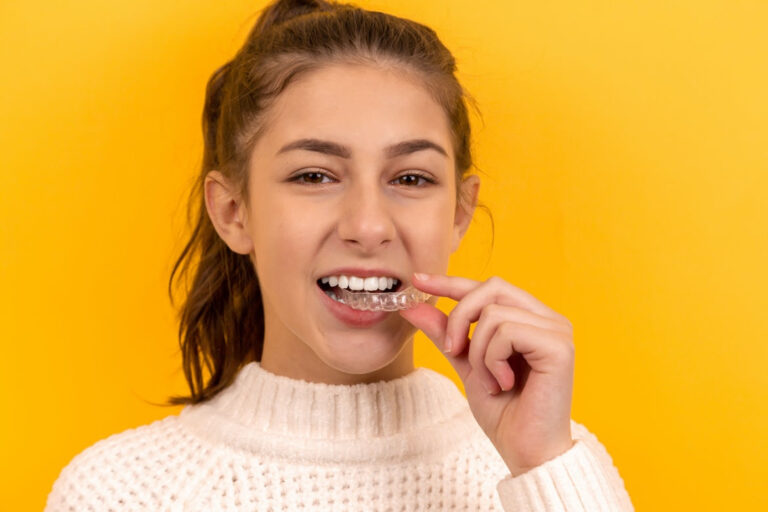 Invisalign, la ortodoncia invisible que es tendencia