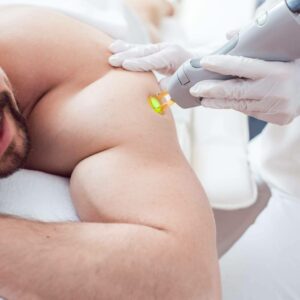 Dermativa, ¿Cuántas sesiones de láser se necesitan para eliminar el vello?
