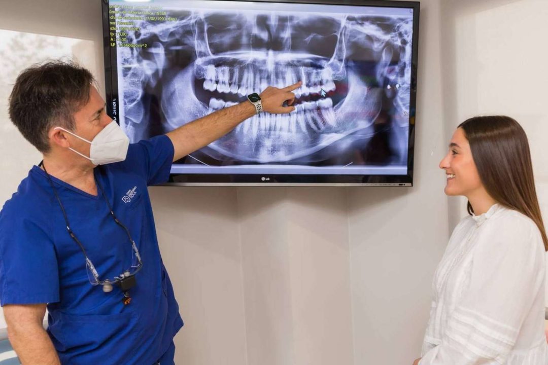 Servicios de implantes dentales en la Clínica Dental Roca