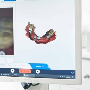 Técnicas de rehabilitación oral en un solo día, con BORDONCLINIC