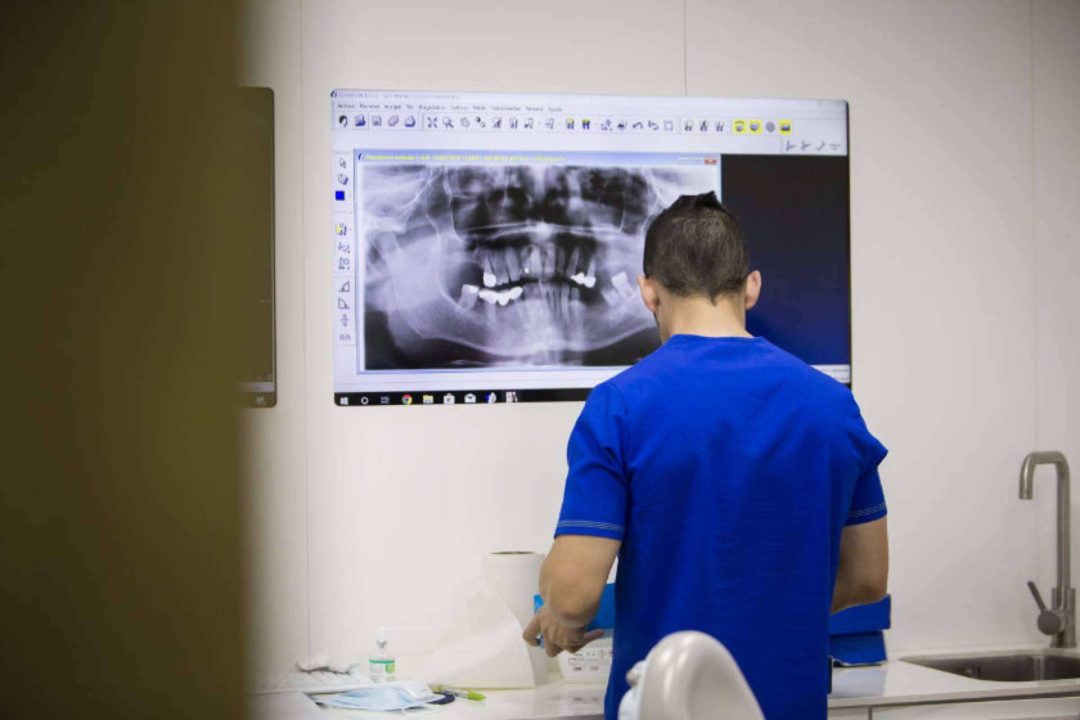 ¿En qué consiste el tratamiento de implantes dentales?, por Cleardent