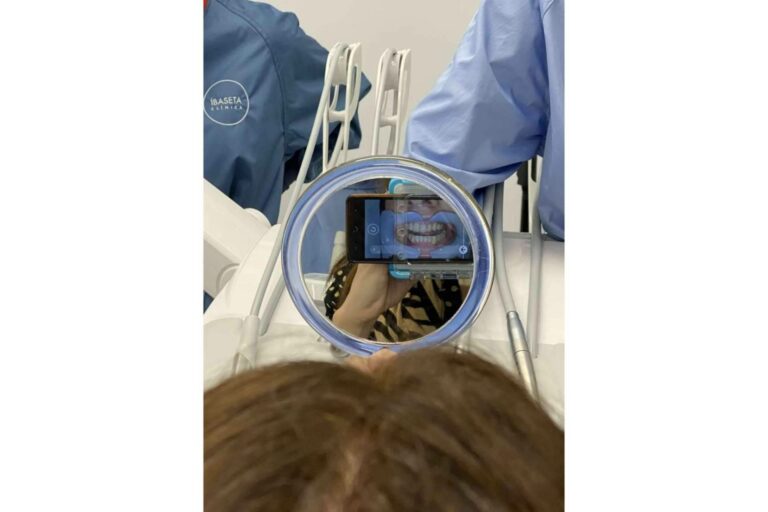 Beneficios de la ortodoncia invisible, según Clínica Ibaseta