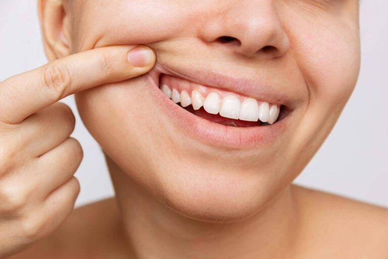 Clínicas Dental Bell, mejorar el aspecto de una sonrisa con un blanqueamiento dental