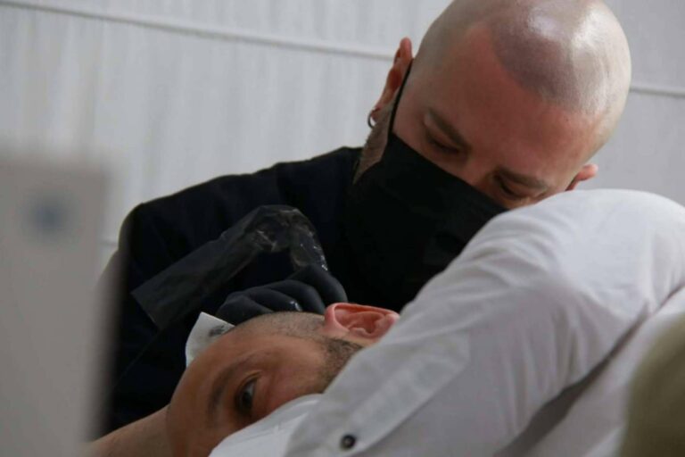 Micropigmentación capilar, una alternativa en auge al trasplante capilar