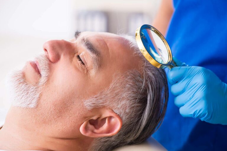 Implantes capilares con Clínicas Élite Capilar, destacados expertos en el sector