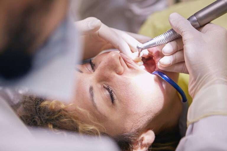 Implantes cigomáticos: la solución para pacientes sin hueso
