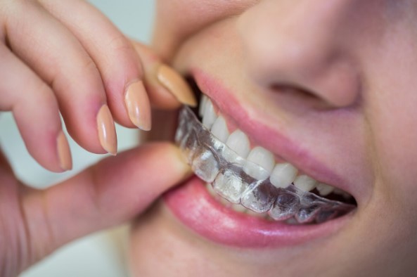 ¿Cómo dar con una buena clínica dental especializada en periodoncia, implantes y estética dental en Córdoba?