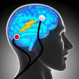 Vanguardia en tratamientos de salud mental con neuromodulación