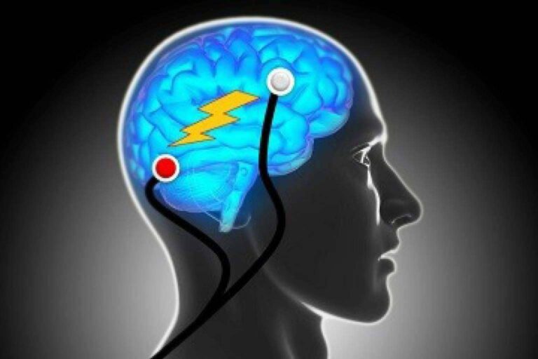Vanguardia en tratamientos de salud mental con neuromodulación