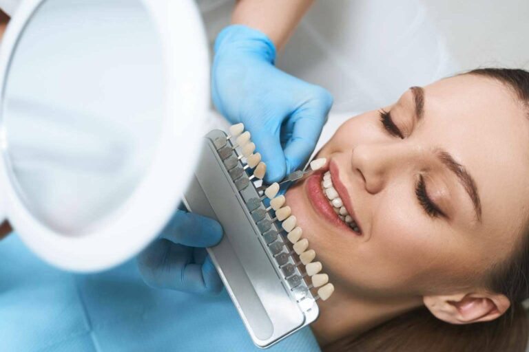 Los riesgos de la obsesión por el blanqueamiento dental