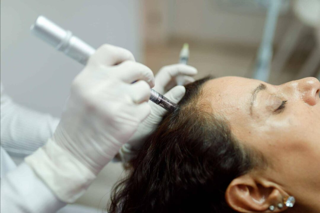 ¿Cómo frenar la caída del cabello? Exosomas, la tendencia en tratamientos capilares