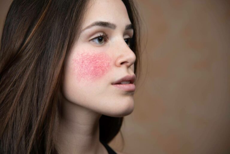 Evoderm, dermocosmética eficaz con ingredientes limpios y aval profesional