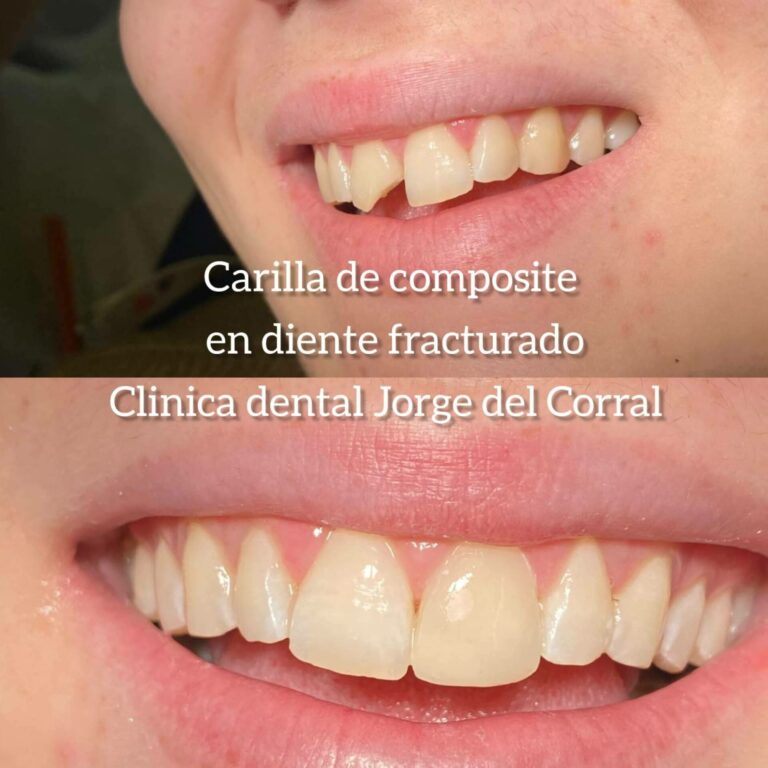 Jorge del Corral, la clínica dental de referencia en Hortaleza para estética y salud bucodental