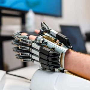 HANK, BELK y Hand of Hope, los nuevos aliados de la neurorrehabilitación robótica en la red de clínicas de Gogoa
