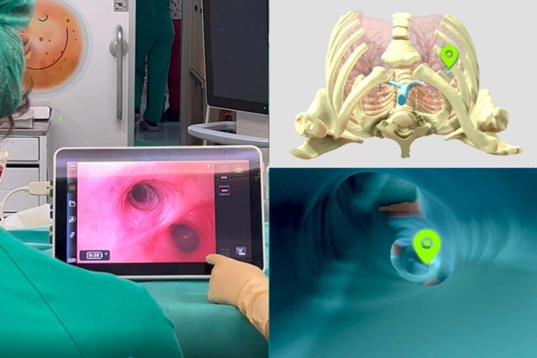 El Hospital Universitario La Paz integra ingeniería clínica en el quirófano para cirugía torácica pediátrica con navegación virtual