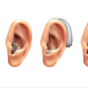 Se plantea cuántos tipos de audífonos existen y cuál se adapta mejor a cada persona