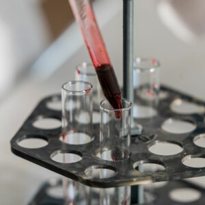 La sanidad andaluza suma una prueba en sangre al diagnóstico del alzhéimer