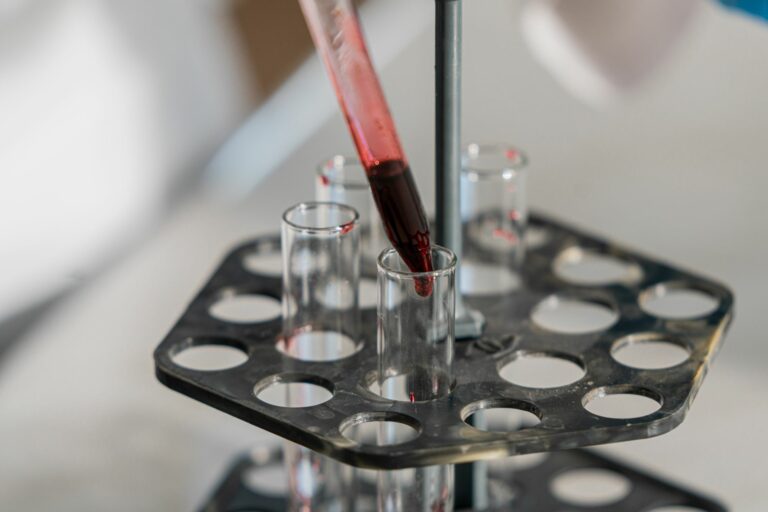 La sanidad andaluza suma una prueba en sangre al diagnóstico del alzhéimer