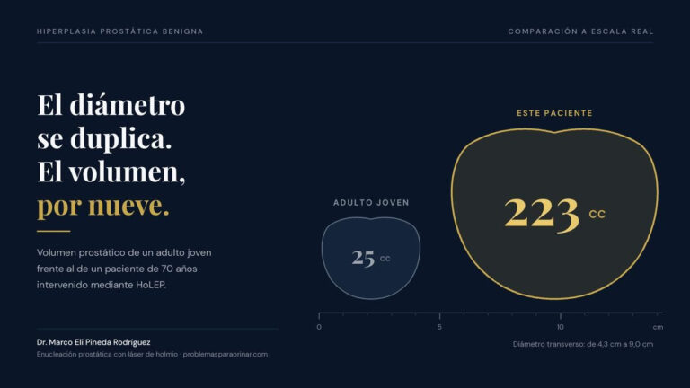 Recupera tu vida en 24 horas: La solución definitiva para problemas de próstata
