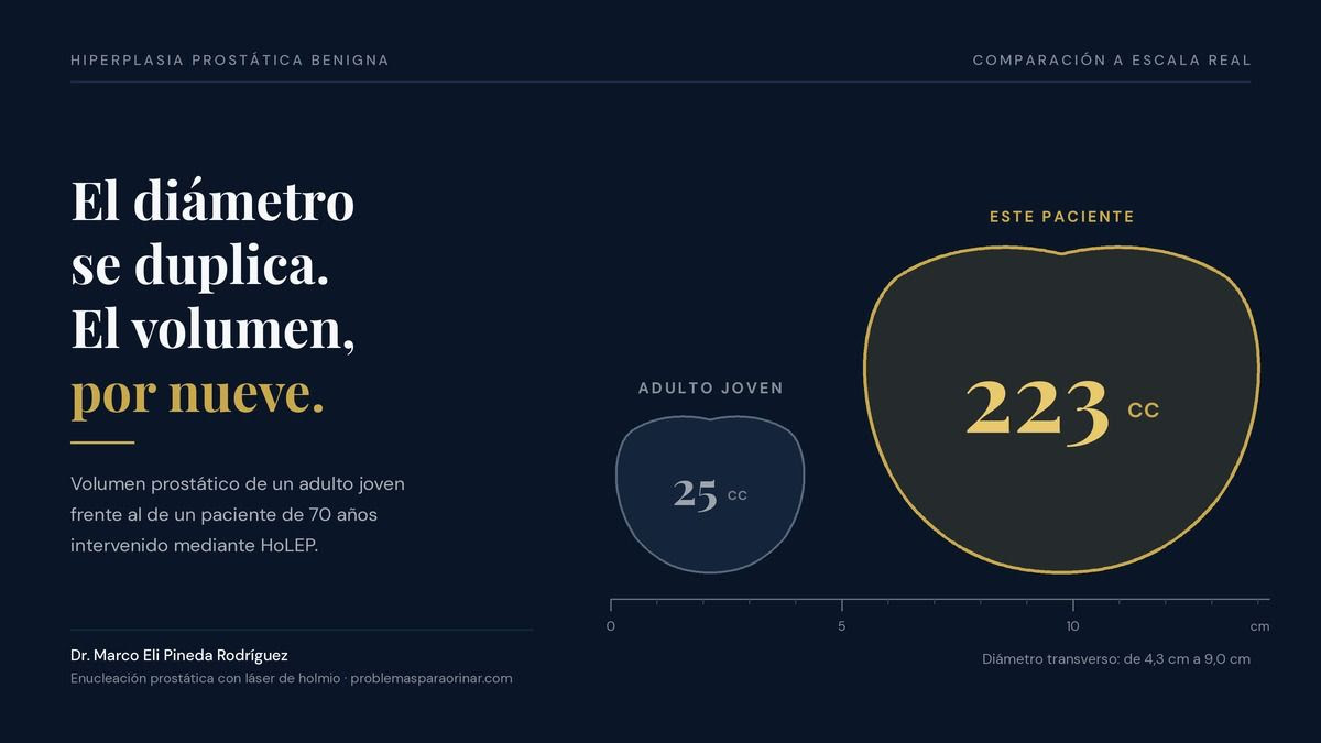 Recupera tu vida en 24 horas: La solución definitiva para problemas de próstata